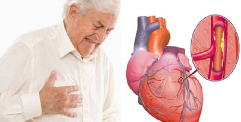 gejala penyakit jantung